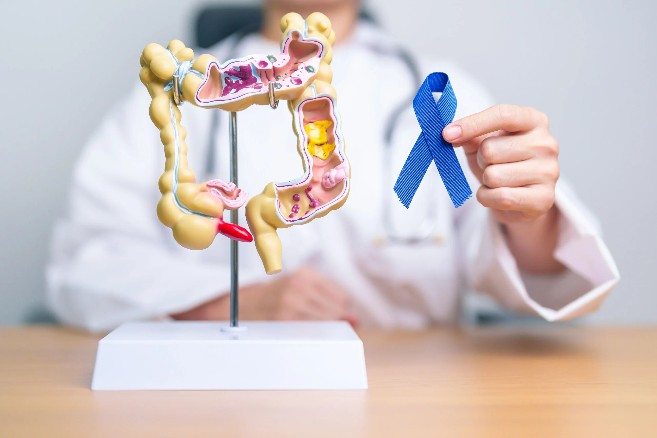 Intestinal Cancer is Third Most Frequent Tumor in Amazonas